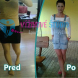 Redukcia a formovanie postavy